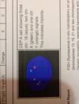 Foetal karyotyping proves triploidy is the cause for the recurrent miscarriage with donor sperm IUI