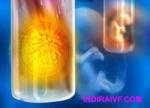 IVF Treatment, test tube baby process, Test Tube Baby Procedure