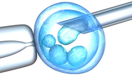 How to Choose an IVF Specialist & Fertility clinic