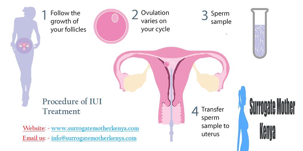 Kenya IUI procedure step by step - surrogate mother Kenya