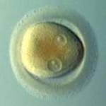 NEW TECHNIQUES IN IVF  