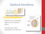 Painless delivery (Epidural anesthesia)